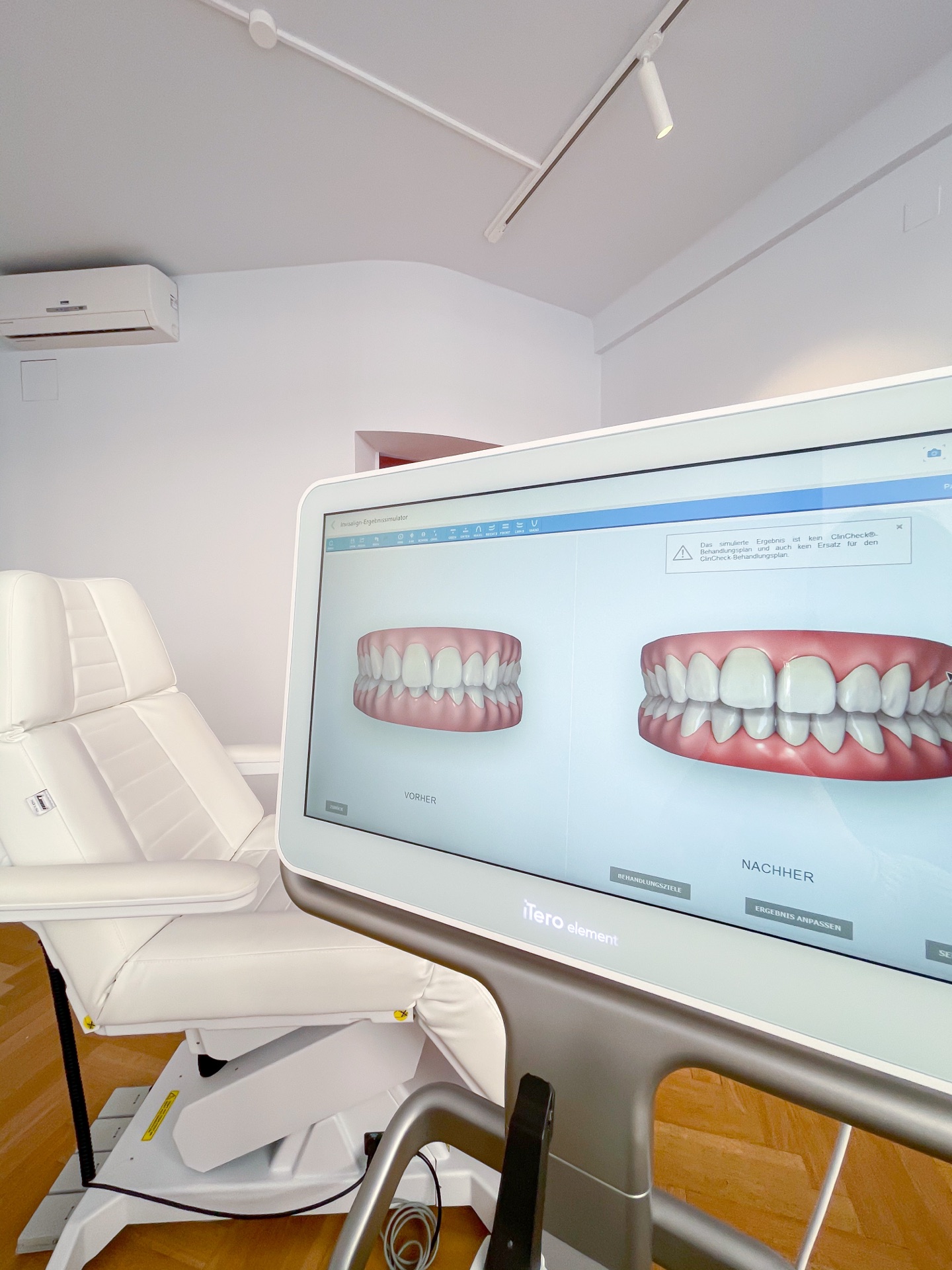 3D-Simulation der Zahnschienen